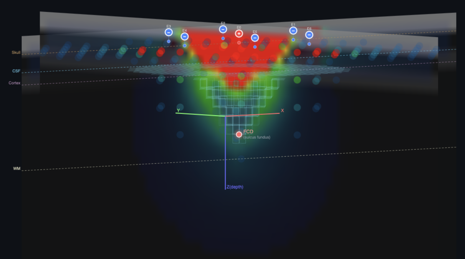 Example simultion image of Epicranial Electric fields