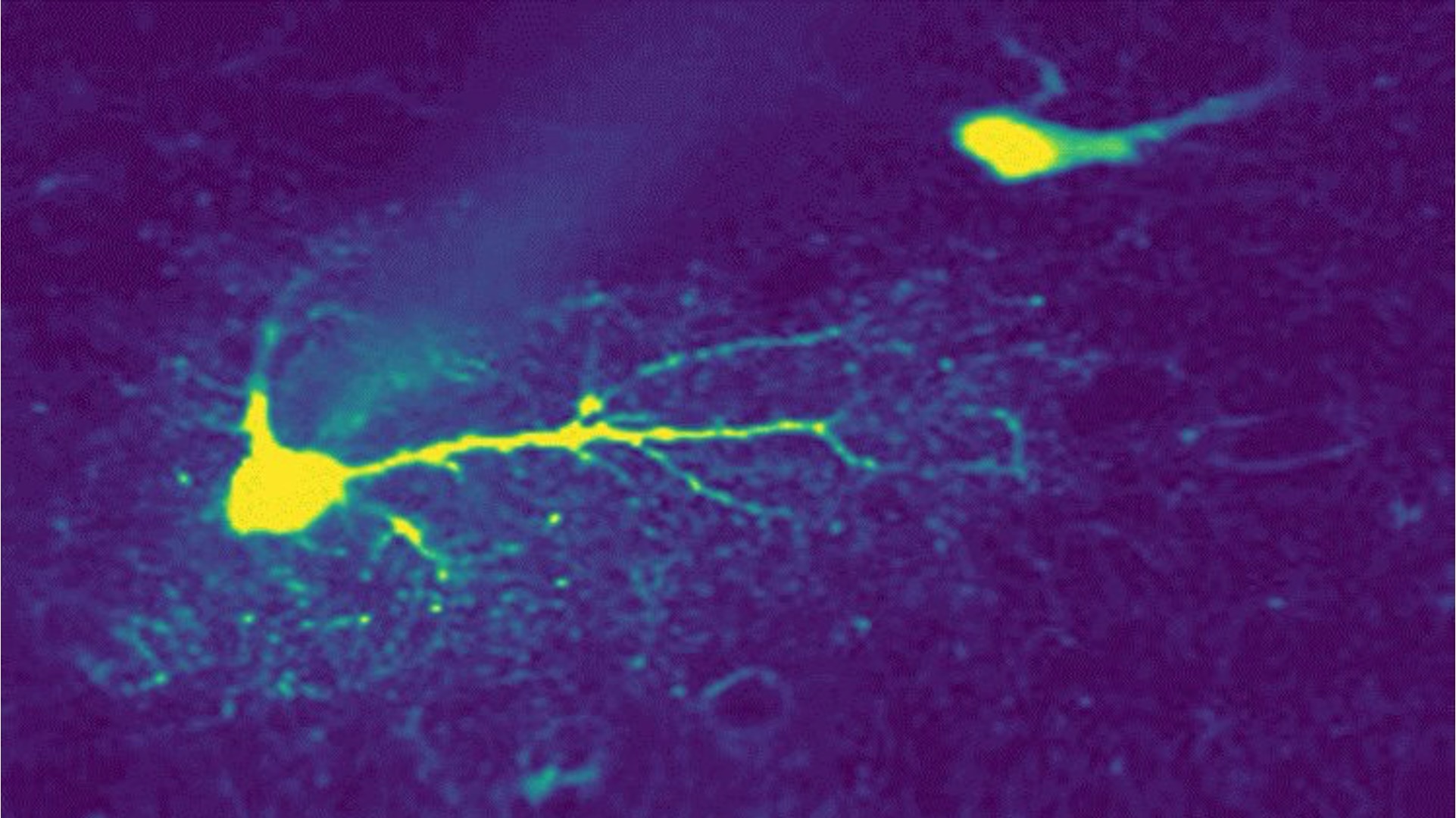 Stylised astrocyte with calcium hotspots